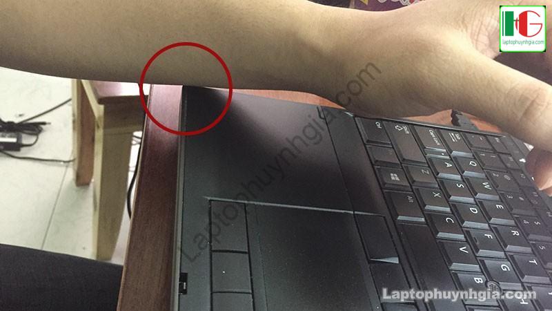 Tai Sao Laptop Bi Nhiem Dien Va Huong Dan Cach Khac Phuc 4747